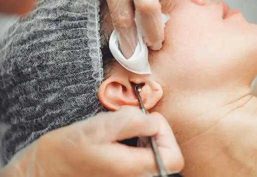 Impacted Ear Wax thumb