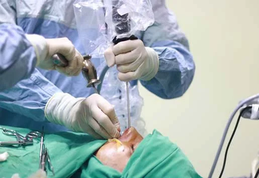 Surgical correction thumb