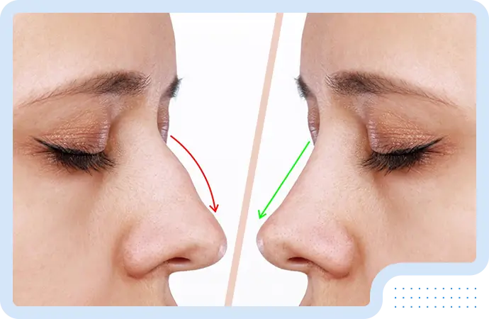 What is nose & facial plastic surgery?